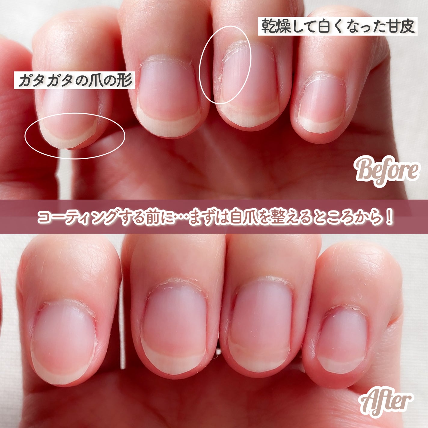 ストロングガード/D-UP/ネイル・ネイルケアを使ったクチコミ(2枚目)