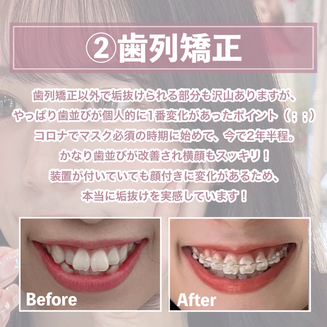 ファンデーションカラーズ/キャンメイク/マニキュアを使ったクチコミ（3枚目）