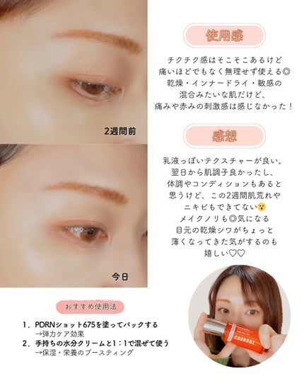 PDRNショット675/COSNORI/美容液を使ったクチコミ(5枚目)