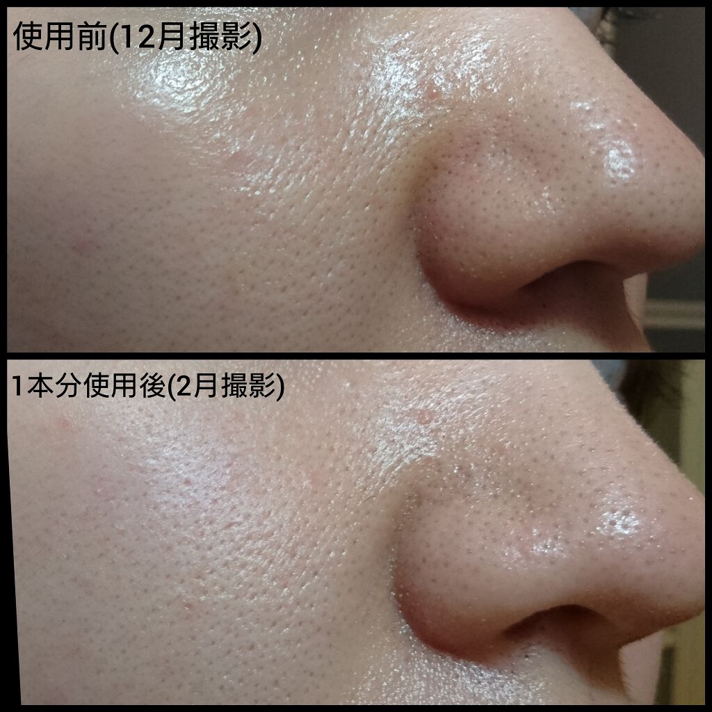 ジェニフィック アドバンスト N/LANCOME/美容液を使ったクチコミ(4枚目)