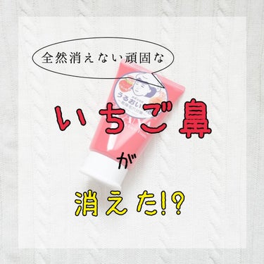 
【毛穴撫子 重曹泡洗顔🍓】



今回は”毛穴撫子 重曹泡洗顔”を紹介します☺︎
前置きが長いので早く内容が見たい方は
☁まで飛んでください



私は初めてニキビができたのが小4で
そこからだんだん