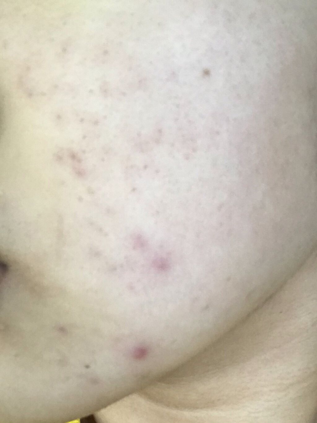 菊正宗 日本酒の化粧水 高保湿/菊正宗/化粧水を使ったクチコミ（3枚目）