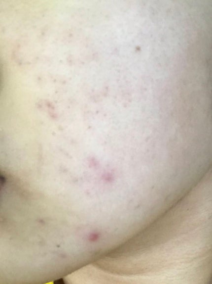 菊正宗 日本酒の化粧水 高保湿/菊正宗/化粧水を使ったクチコミ(3枚目)