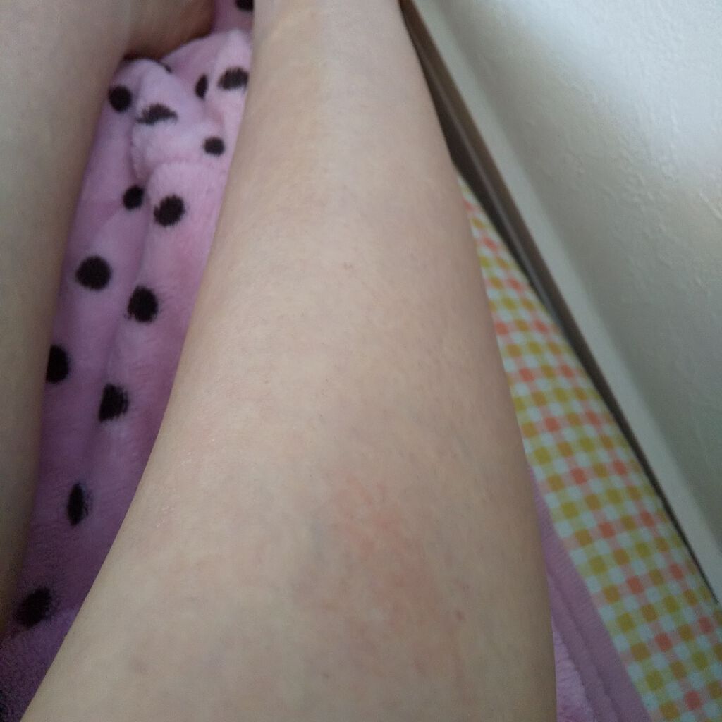 deleMO/deleMO/除毛クリームを使ったクチコミ(2枚目)