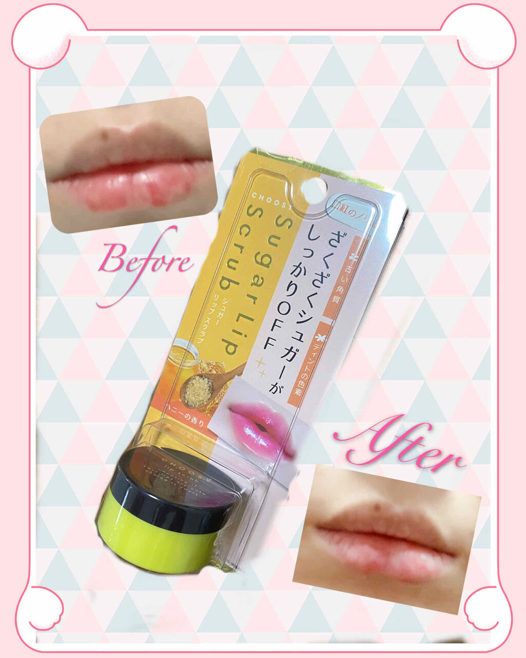 シュガーリップスクラブ/CHOOSY/リップスクラブを使ったクチコミ（1枚目）