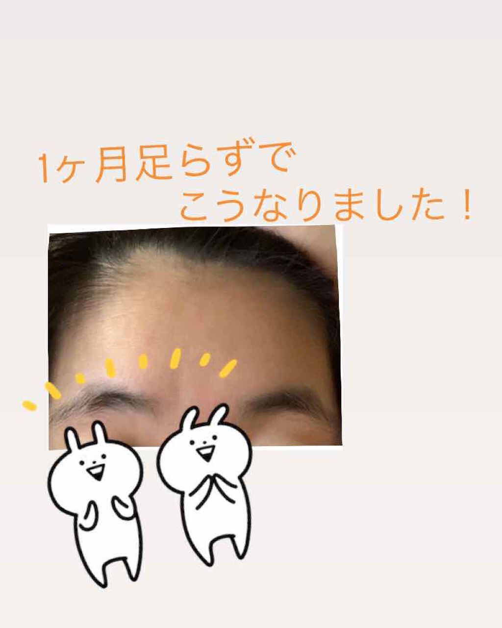 ワンダーハニー ベジマスク レモン/VECUA Honey/洗い流すパック・マスクを使ったクチコミ（3枚目）