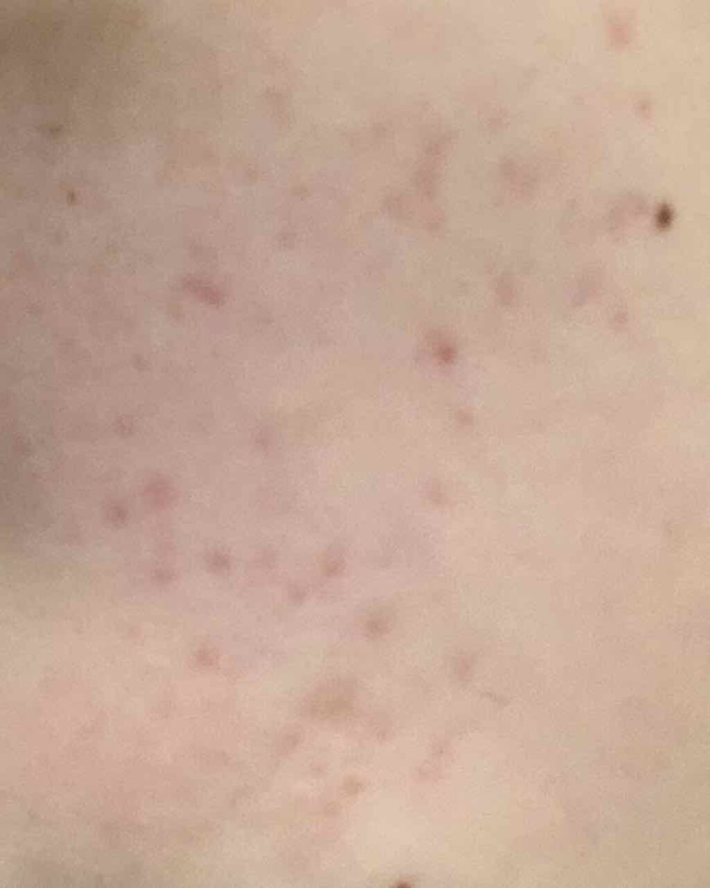 AHA·BHA·PHA 30デイズミラクルトナー/SOME BY MI/化粧水を使ったクチコミ（3枚目）