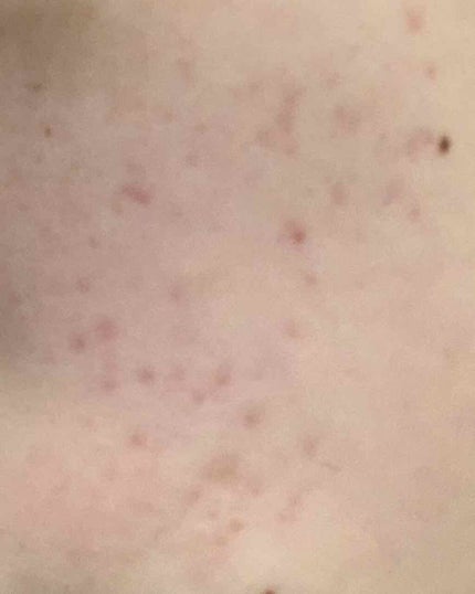 AHA·BHA·PHA 30デイズミラクルトナー/SOME BY MI/化粧水を使ったクチコミ(3枚目)