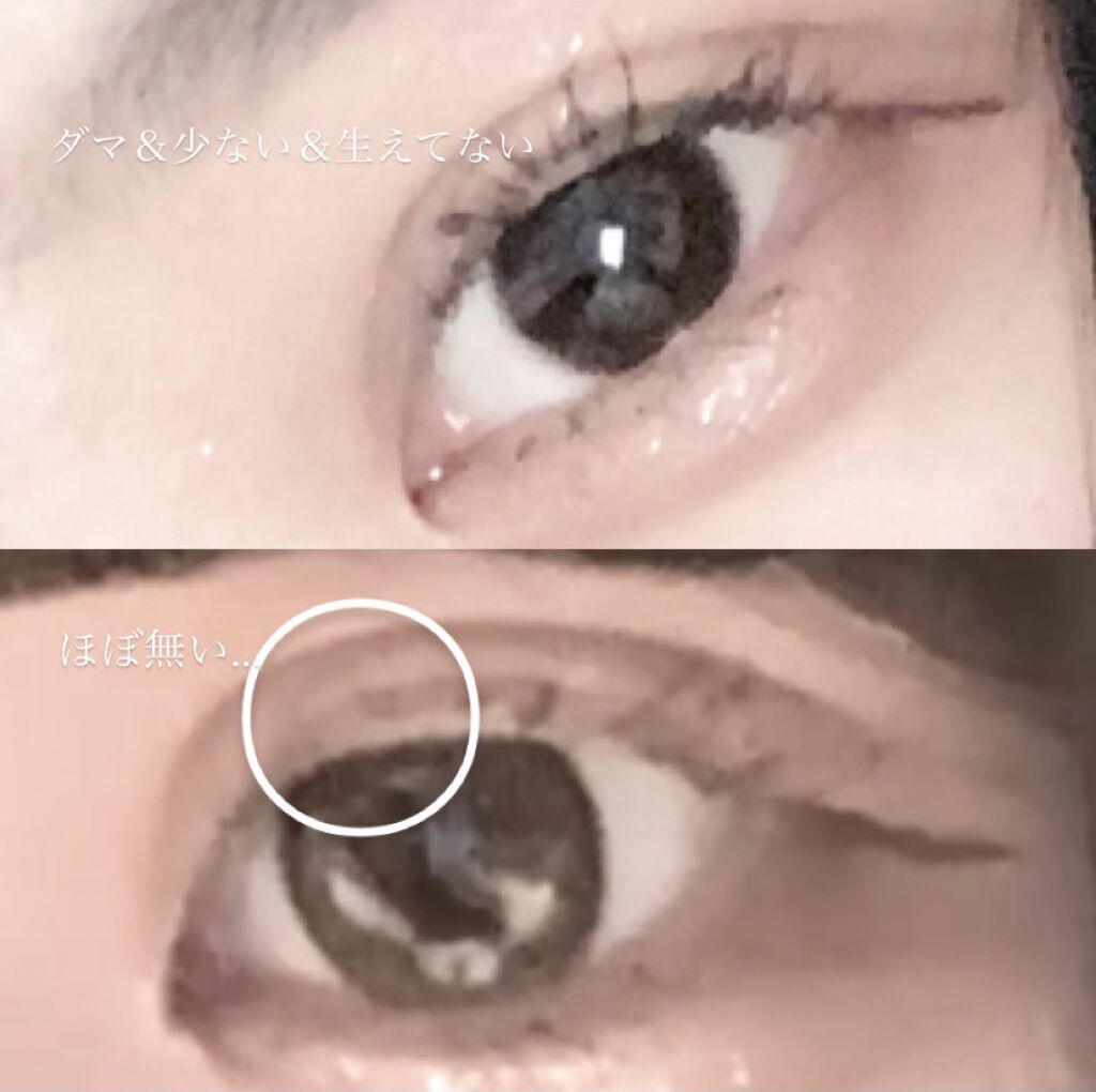 スカルプD ボーテ ピュアフリーアイラッシュセラム/アンファー(スカルプD)/まつげ美容液を使ったクチコミ（2枚目）