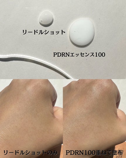 リードルショット300/VT/美容液を使ったクチコミ(4枚目)