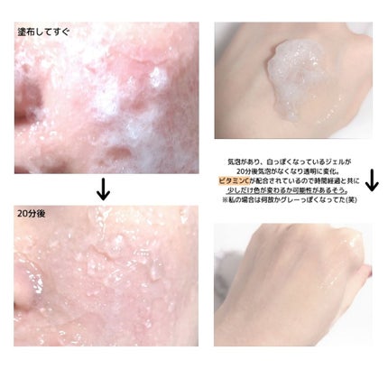 ドクターメディオン スパオキシジェル/ドクターメディオン/洗い流すパック・マスクを使ったクチコミ(3枚目)