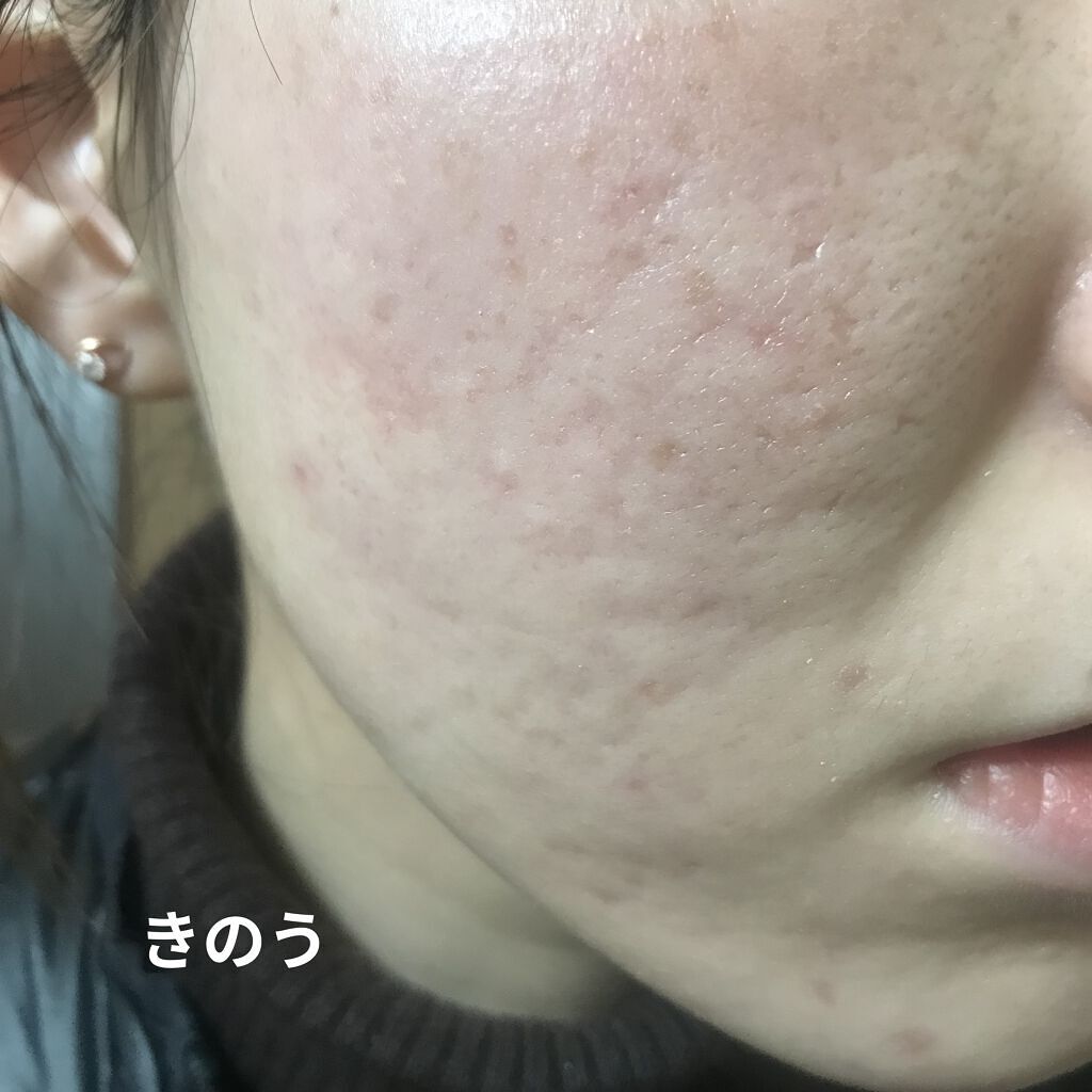 スキンイリュージョンプライマーＵＶｎ/コフレドール/化粧下地を使ったクチコミ（3枚目）