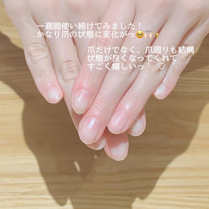 ボタニカルクリアコート/アンドネイル/ネイルオイル・トリートメントを使ったクチコミ(6枚目)
