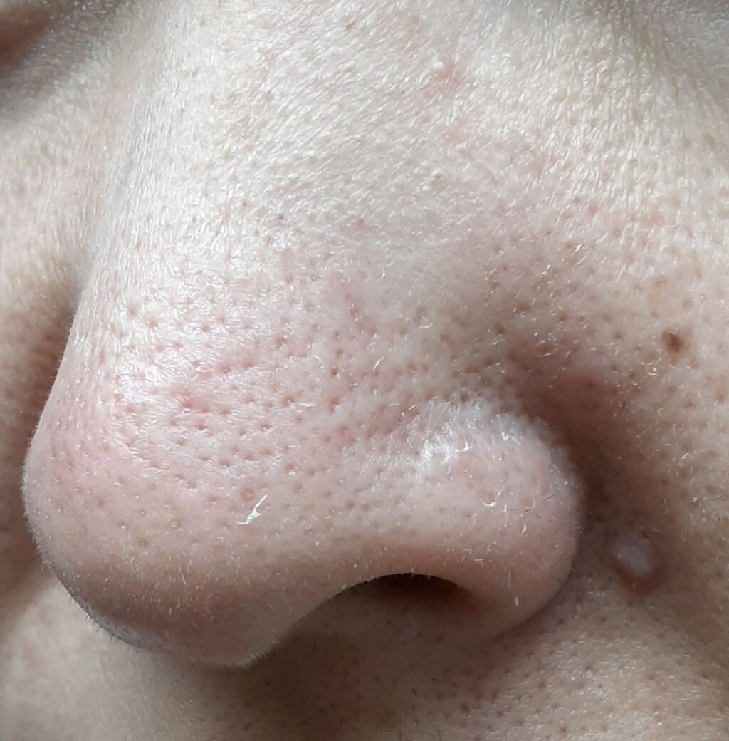 天然こんにゃくパフ/DAISO/その他スキンケアグッズを使ったクチコミ（2枚目）