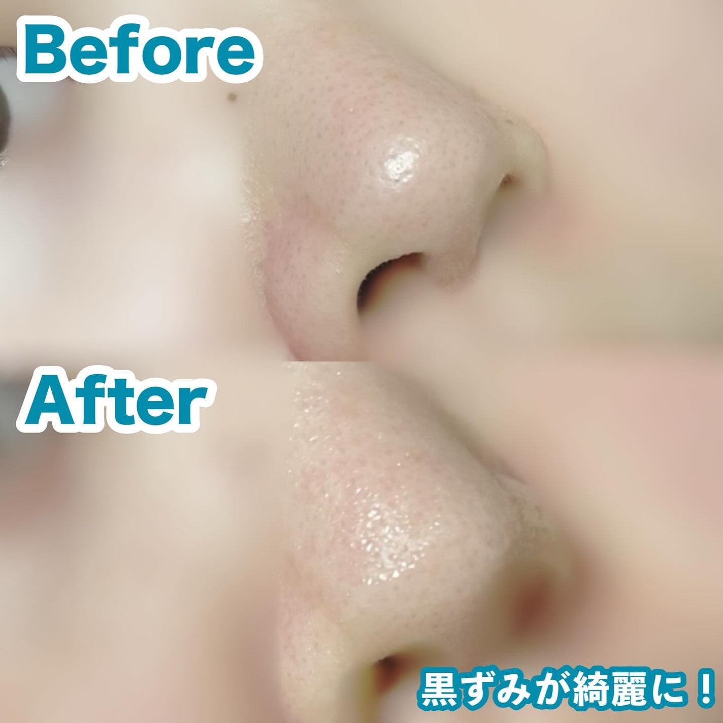 ナチュラルマイルドクリアノーズパック/ilso/シートマスク・パックを使ったクチコミ(4枚目)