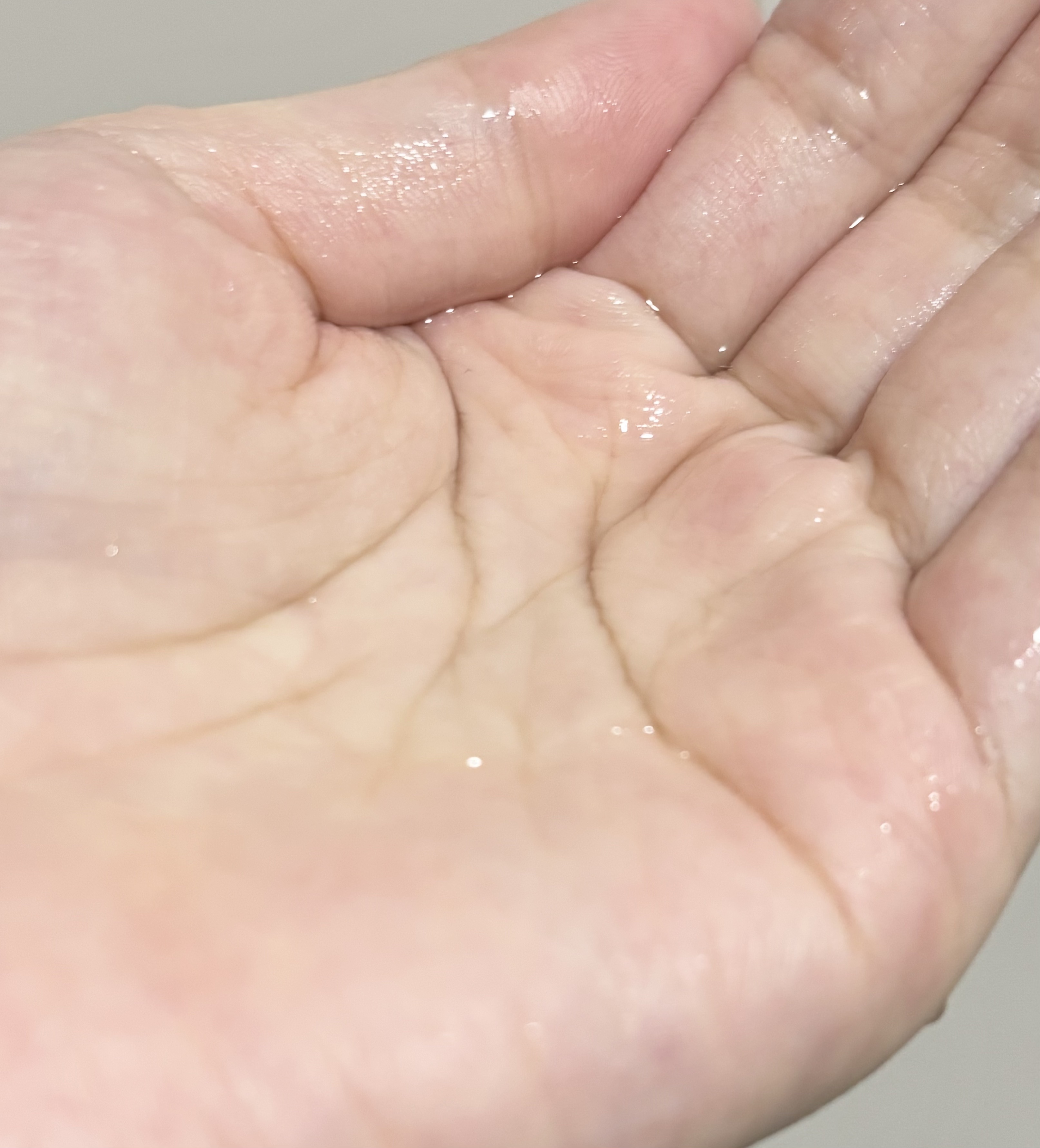 ピンクティーツリートナー/APLIN/化粧水を使ったクチコミ（2枚目）