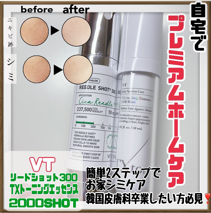 リードルショット300/VT/美容液を使ったクチコミ（3枚目）