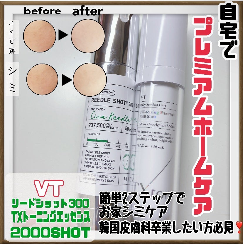 リードルショット300/VT/美容液を使ったクチコミ(3枚目)