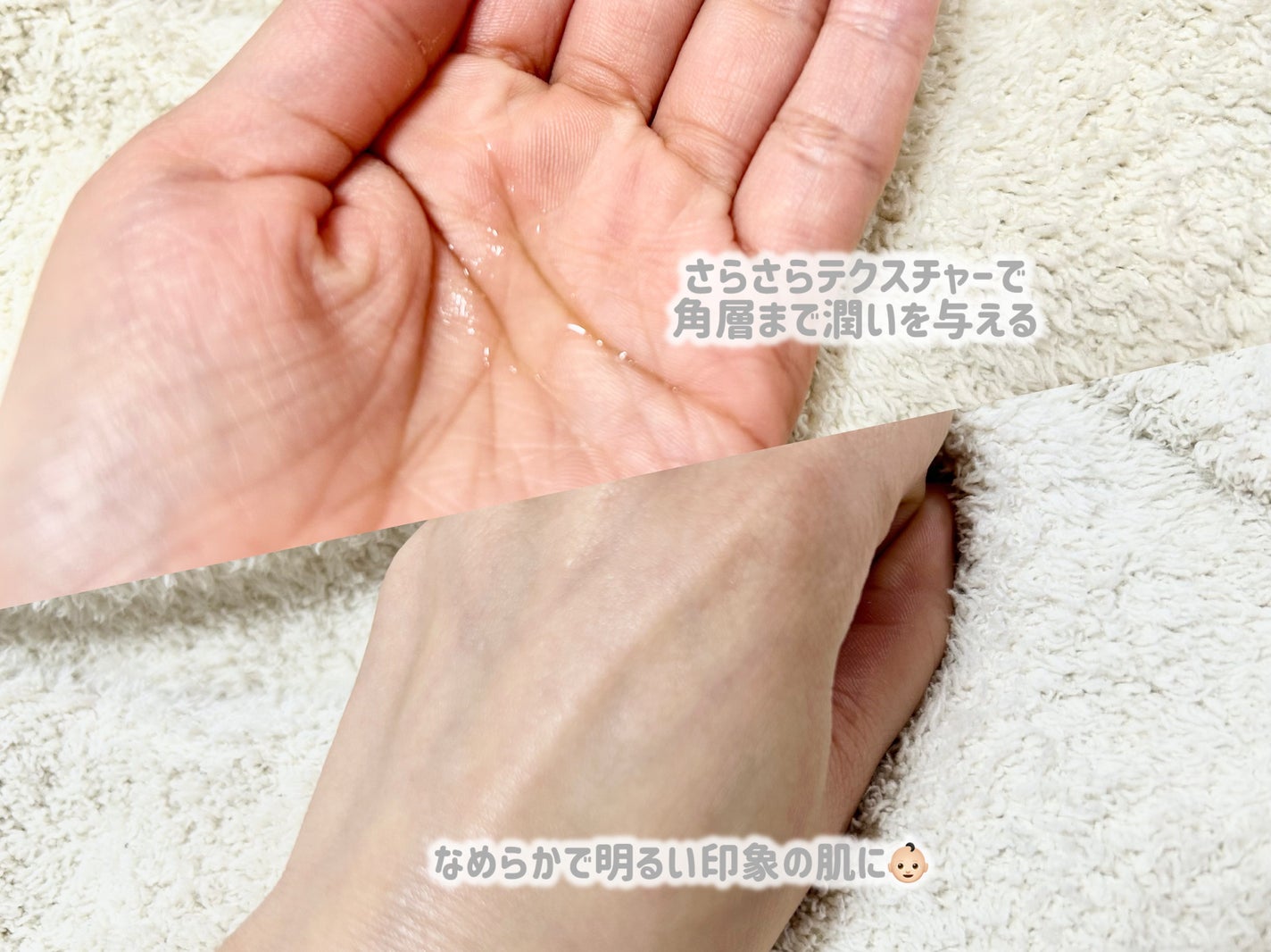 エッセンス(濃縮美容液)/夢幻の舞/美容液を使ったクチコミ(2枚目)