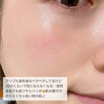 ダーマトックスニードルショット/Easydew/その他スキンケアを使ったクチコミ(9枚目)