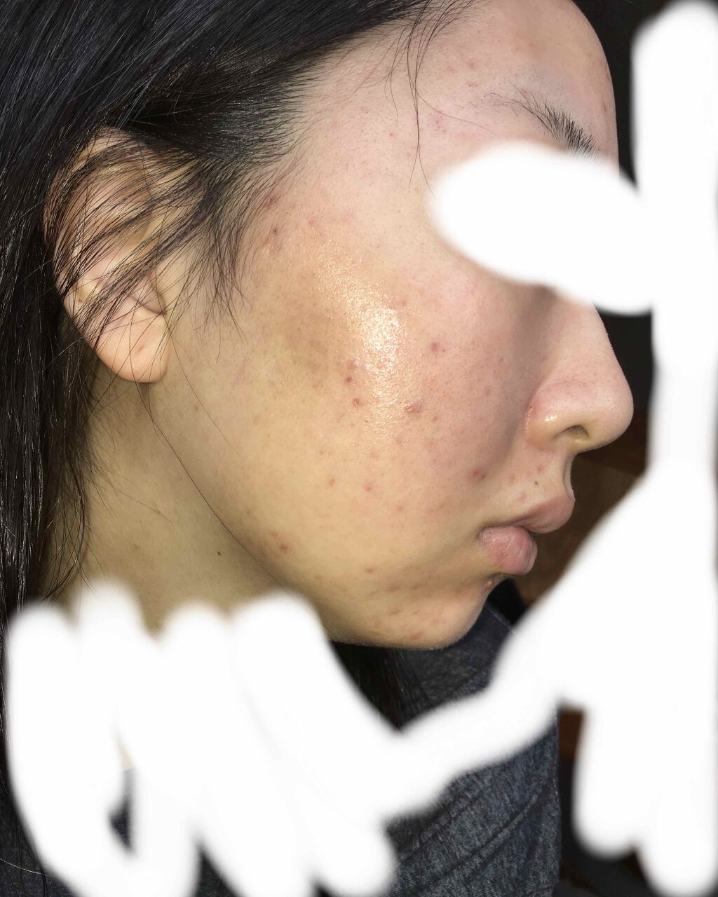 フワフワネコチャン on LIPS 「塗り始めて12日目(13日目朝)の写真です!昨日は忙しくて投稿..」(3枚目)