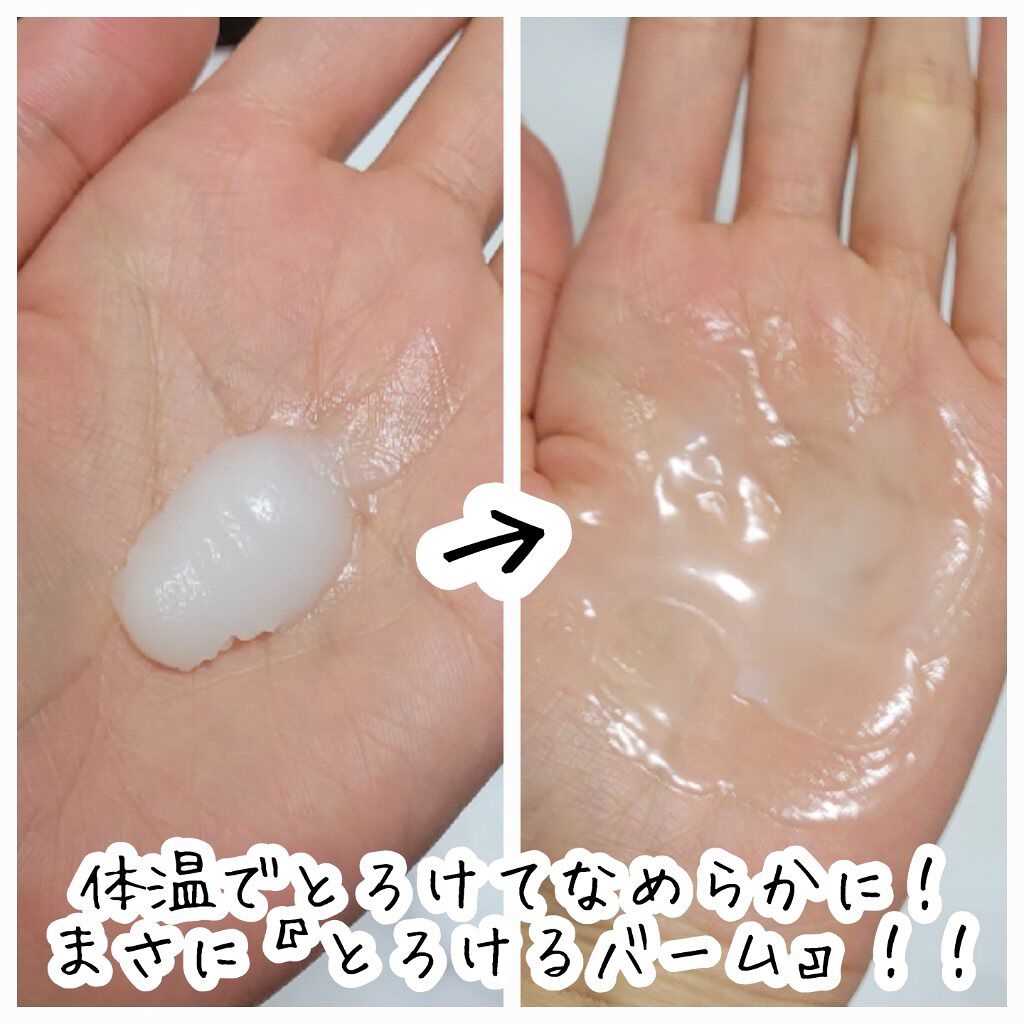 VC クレンジングバーム /SKIO/クレンジングバームを使ったクチコミ（2枚目）