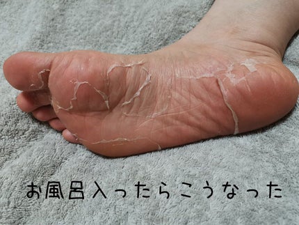 bea's up フットピーリングパック ペロリン グレープフルーツ/素数/レッグ・フットケアを使ったクチコミ(4枚目)