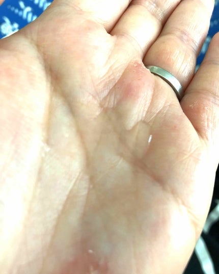 シミ・ソバカス予防ケア 化粧水3(とてもしっとり)/キュレル/化粧水を使ったクチコミ(4枚目)