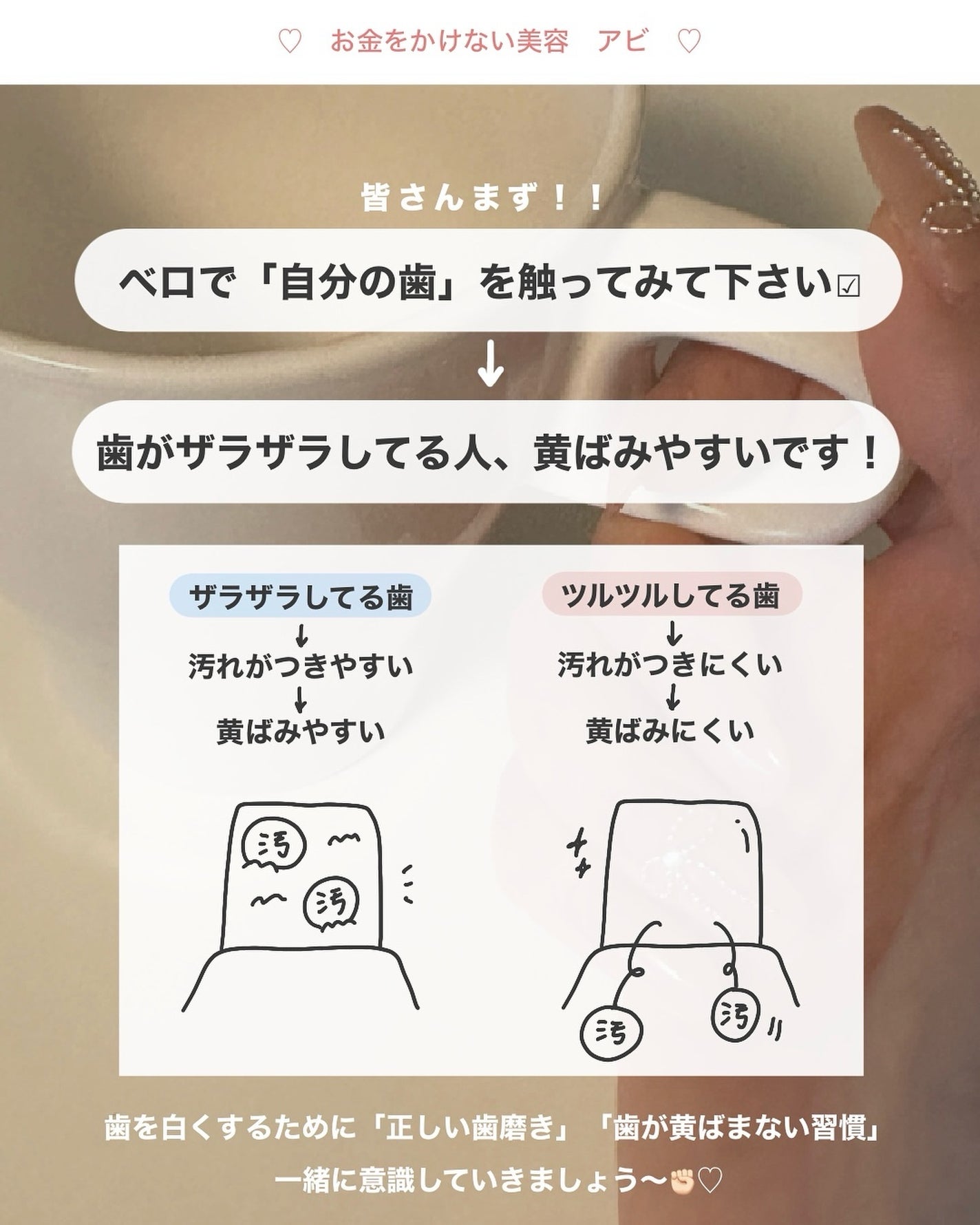 アビ|お金をかけない美容♡ on LIPS 「意外とやってる!?「歯が黄ばむ習慣」は...🫨🫨_______..」(2枚目)