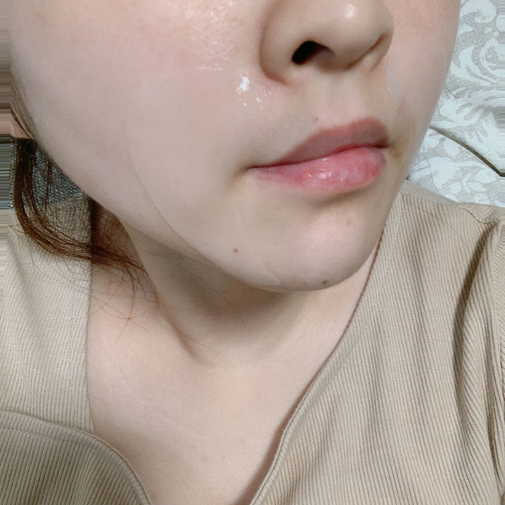 リンクメンテ アイ/野口医学研究所/シートマスク・パックを使ったクチコミ(4枚目)