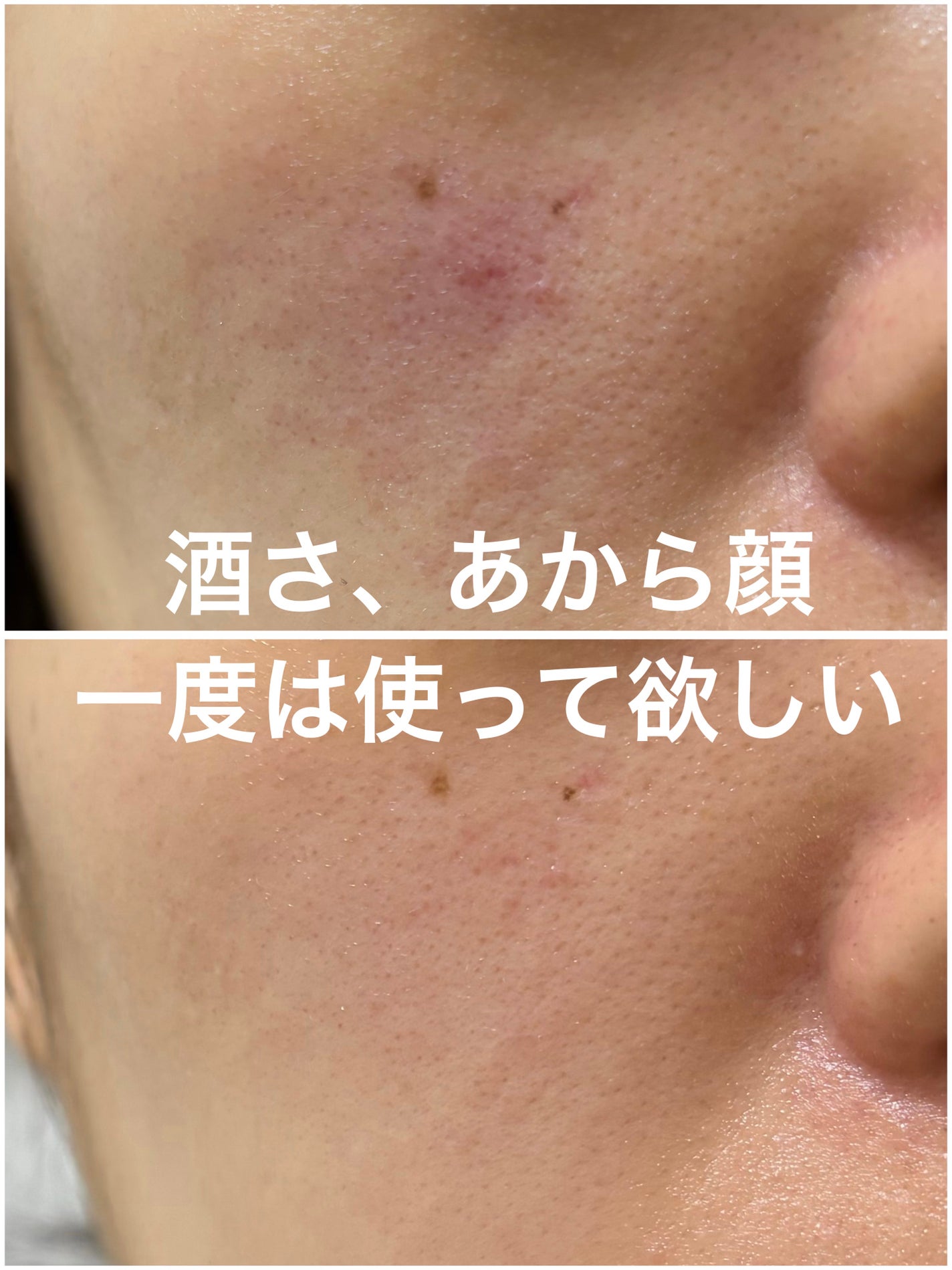 白漢 しろ彩 リペアローション/白漢しろ彩/化粧水を使ったクチコミ(1枚目)