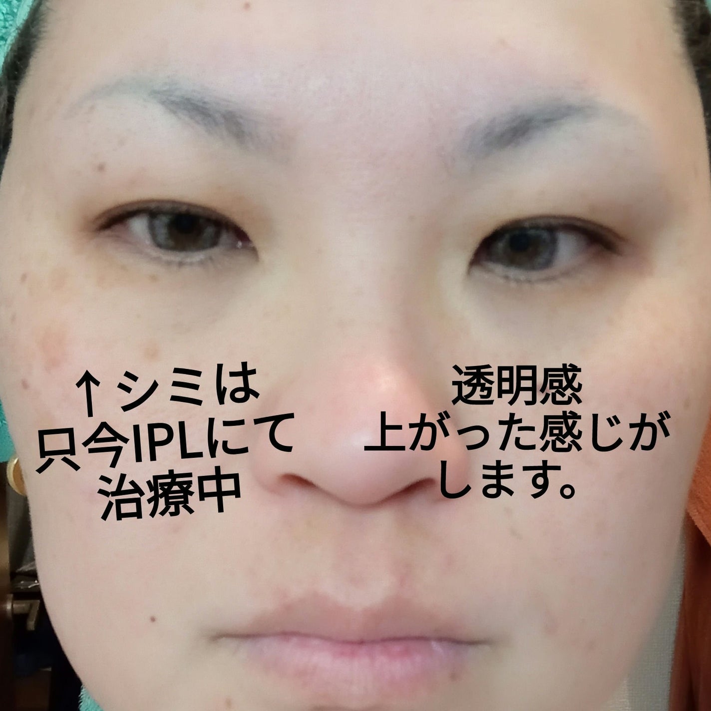 BURLONE ナチュラルソープ ミルキーホワイト/BURLONE/洗顔石鹸を使ったクチコミ(2枚目)