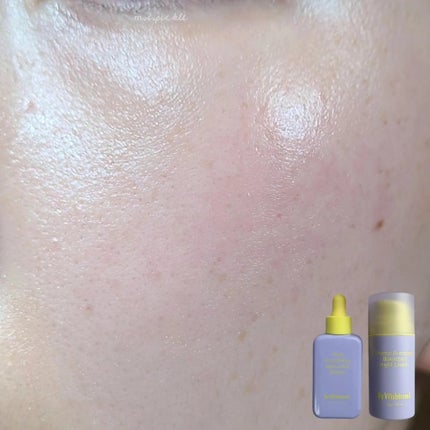 ポアスムージングバクチオールセラム/By Wishtrend/美容液を使ったクチコミ(6枚目)