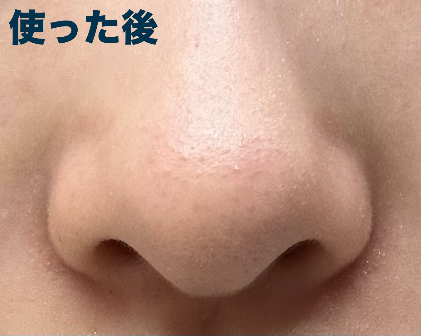 ノーズピーリングパック/One-day's you/シートマスク・パックを使ったクチコミ(3枚目)