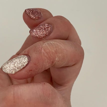 キズクイックfit/東洋化学/その他を使ったクチコミ(4枚目)