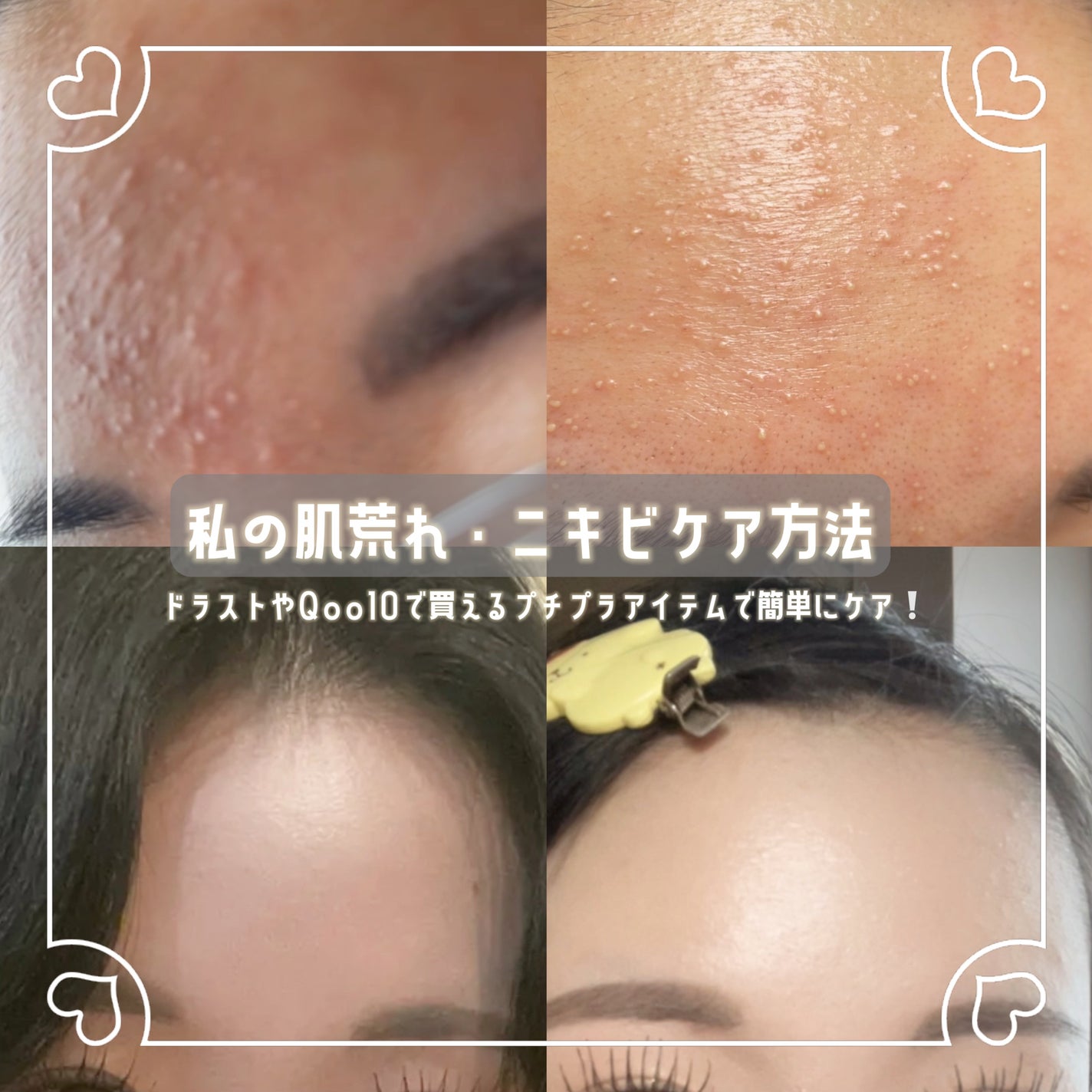 洗顔 クリーム M/雪肌粋/洗顔フォームを使ったクチコミ(1枚目)