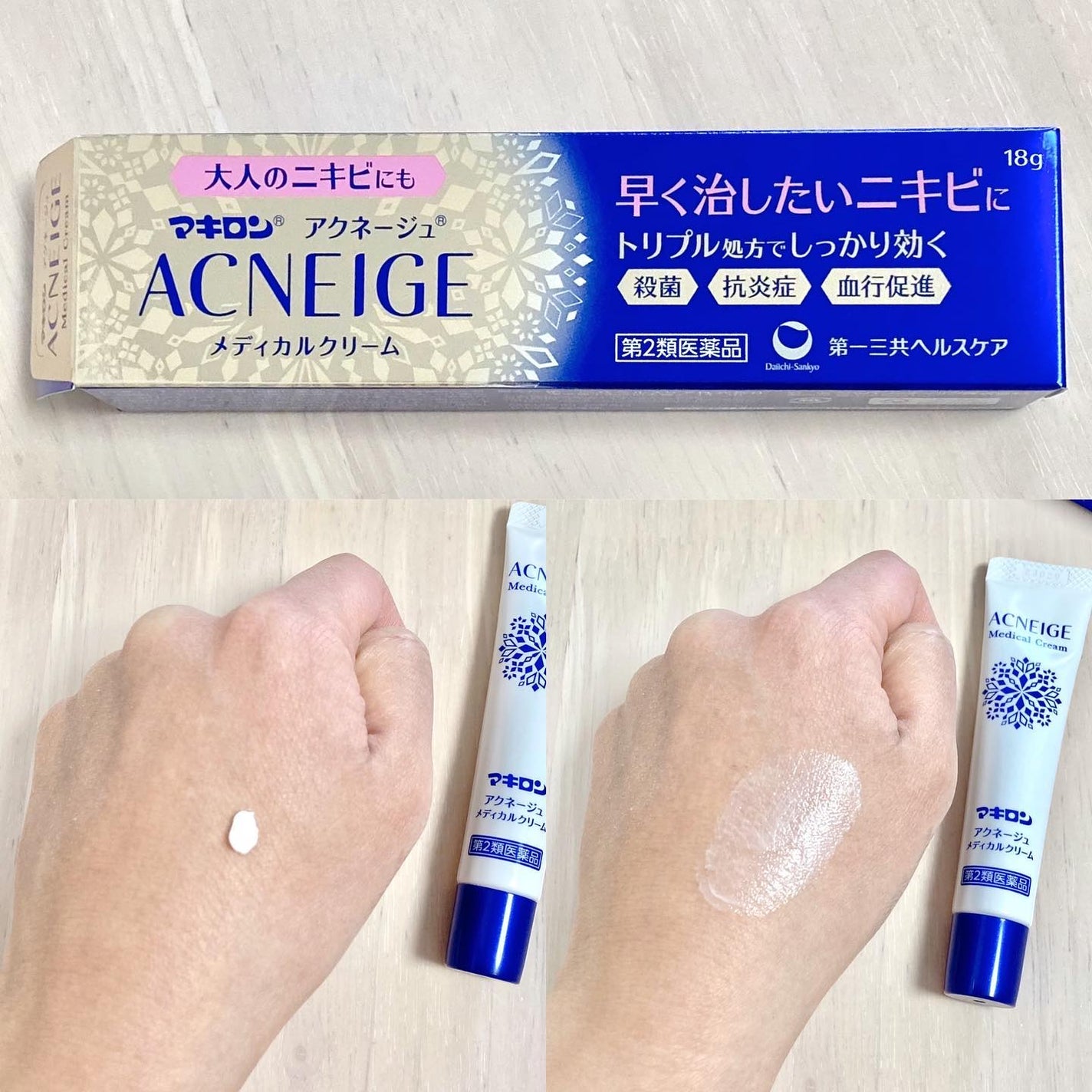 マキロン アクネージュ メディカルクリーム (医薬品) /マキロン/その他を使ったクチコミ(2枚目)