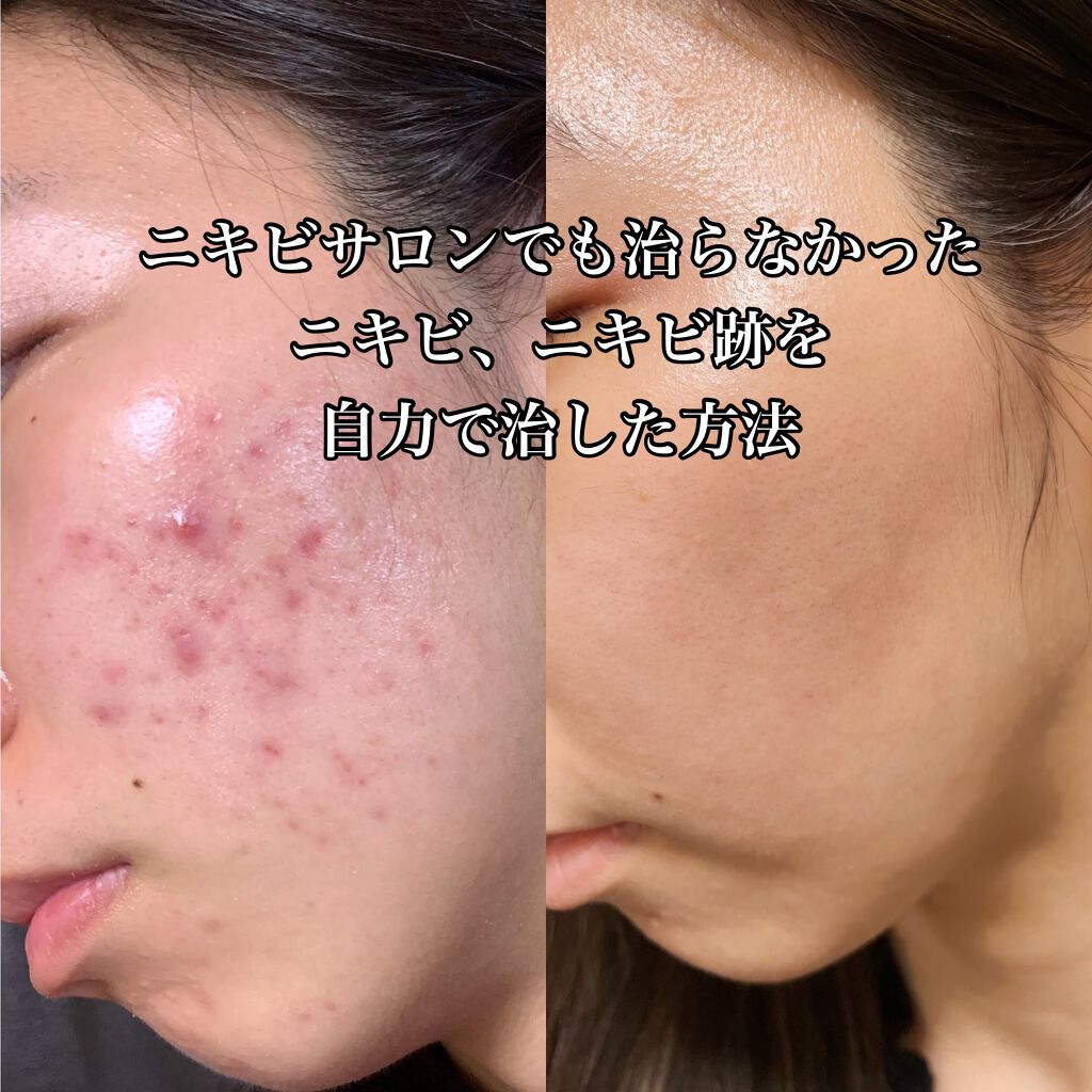 化粧落し/はしかた化粧品/クレンジングジェルを使ったクチコミ(1枚目)