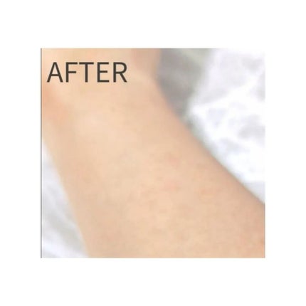 薬用ブラックリムーバー/RODOMIS/除毛クリームを使ったクチコミ(5枚目)