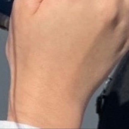 DHC ビタミンCハードカプセル/DHC/美容サプリメントを使ったクチコミ(2枚目)