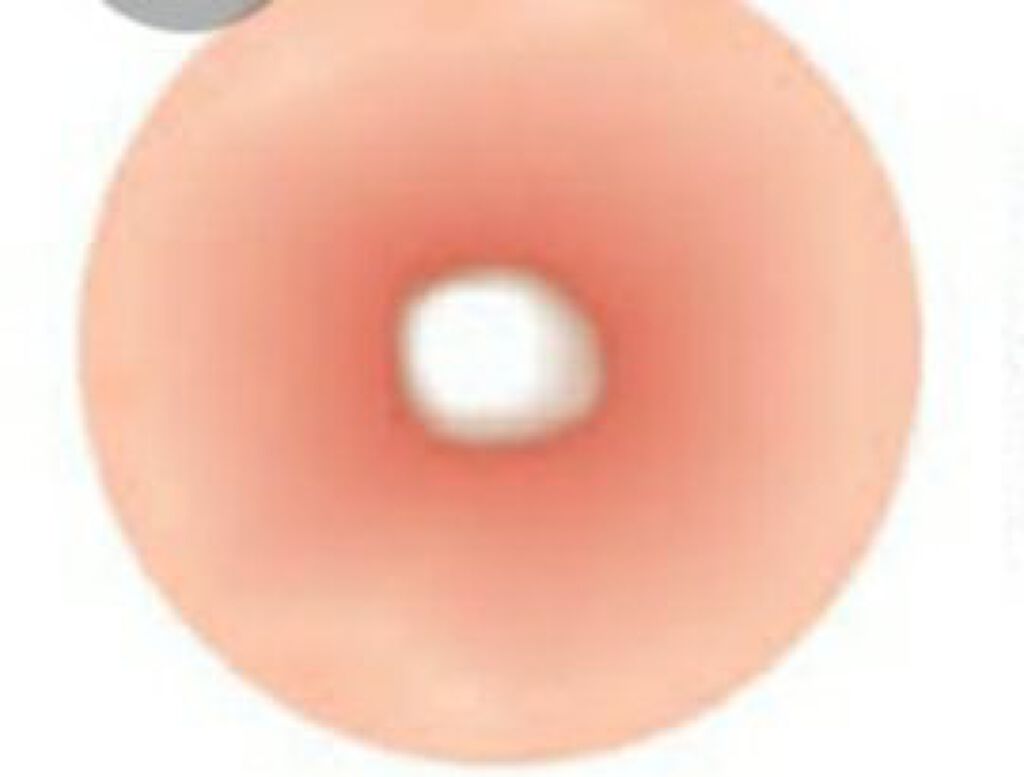 オロナインＨ軟膏 (医薬品)/オロナイン/その他を使ったクチコミ（2枚目）