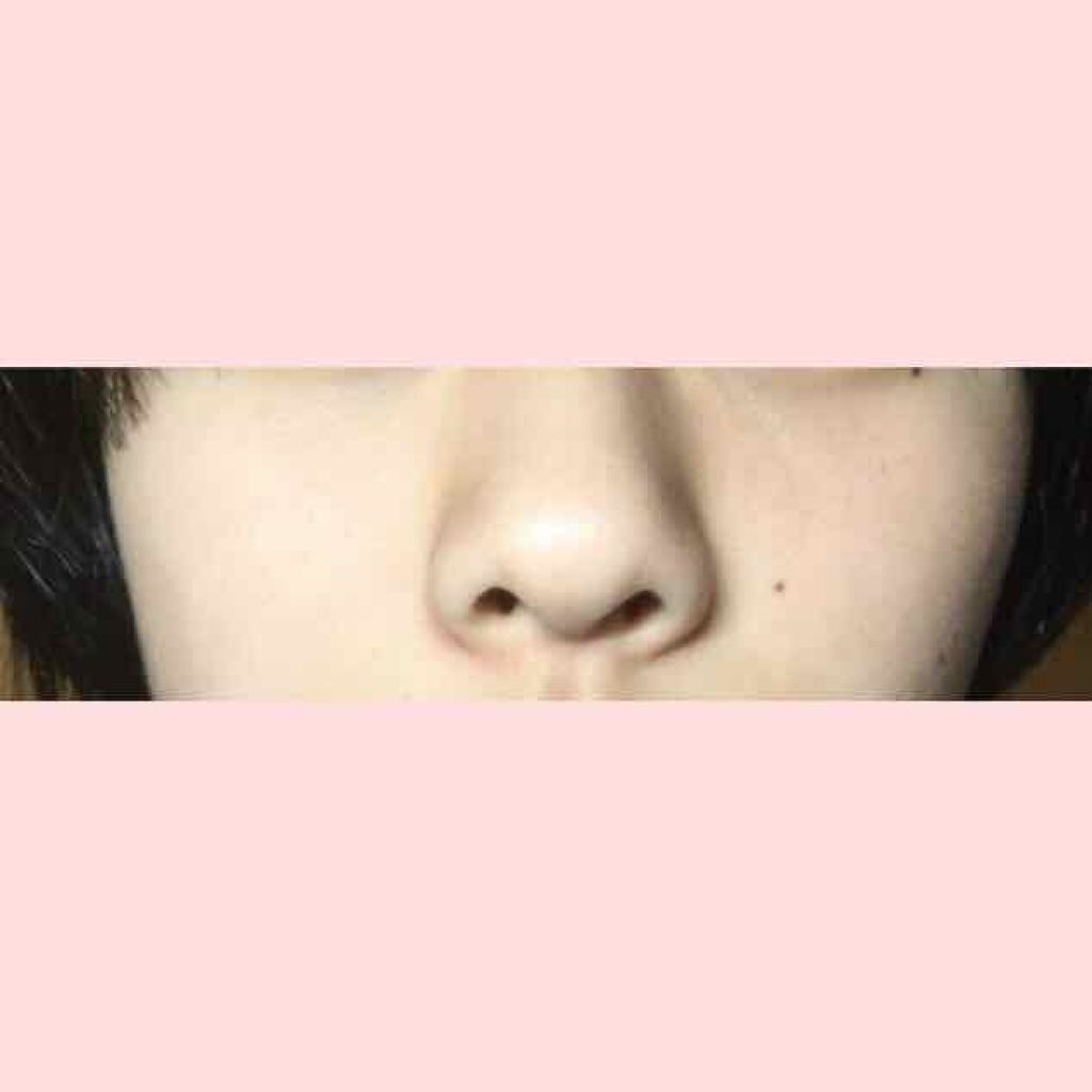 ハトムギ化粧水(ナチュリエ スキンコンディショナー R )/ナチュリエ/化粧水を使ったクチコミ（3枚目）