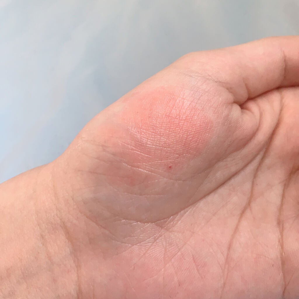 ジューシーラスティングティント/rom&nd/リップティントを使ったクチコミ(3枚目)