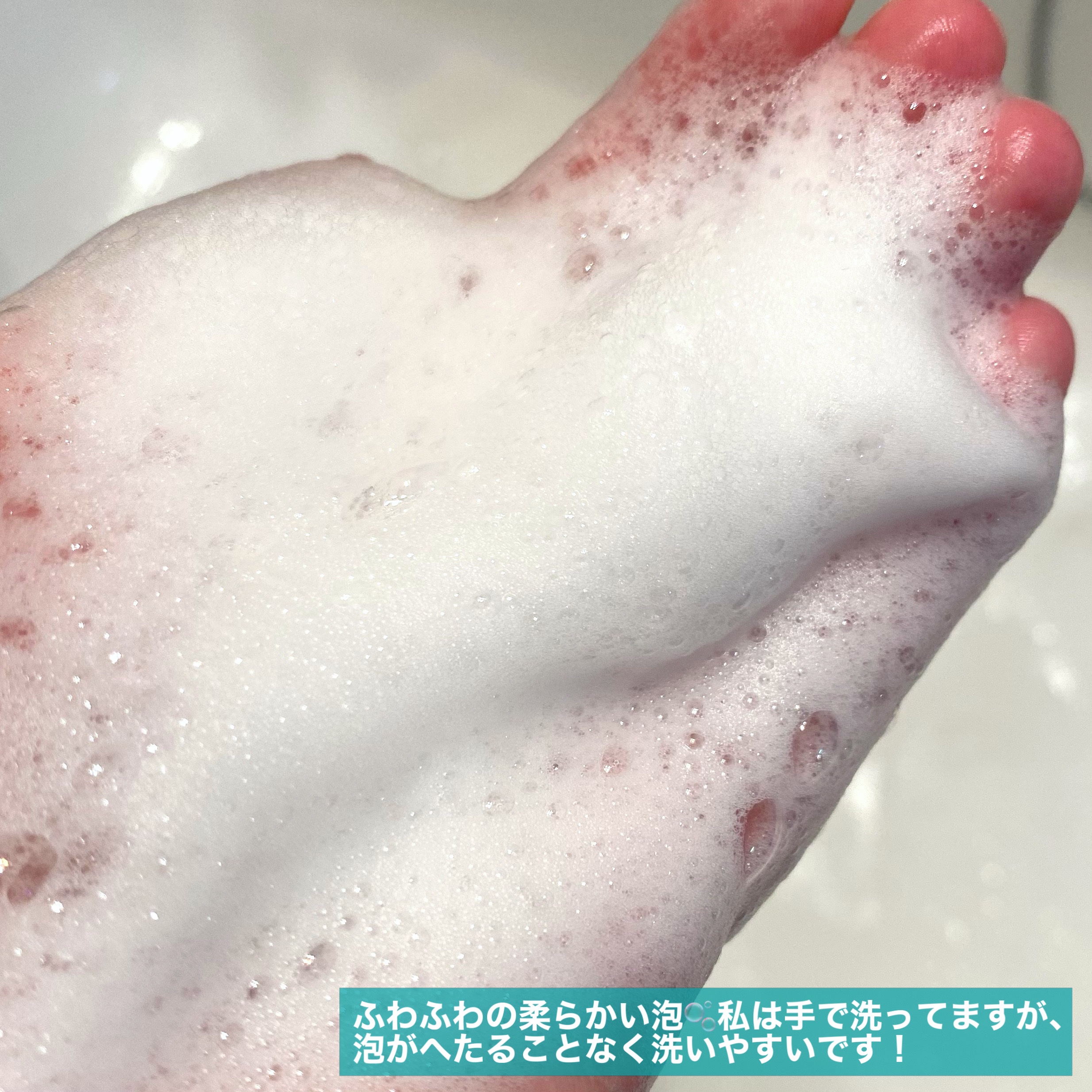 ACコントロールボディミスト/Derma:B/ボディローションを使ったクチコミ（3枚目）