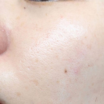 3GF リペアエッセンス/cos:mura/美容液を使ったクチコミ(4枚目)