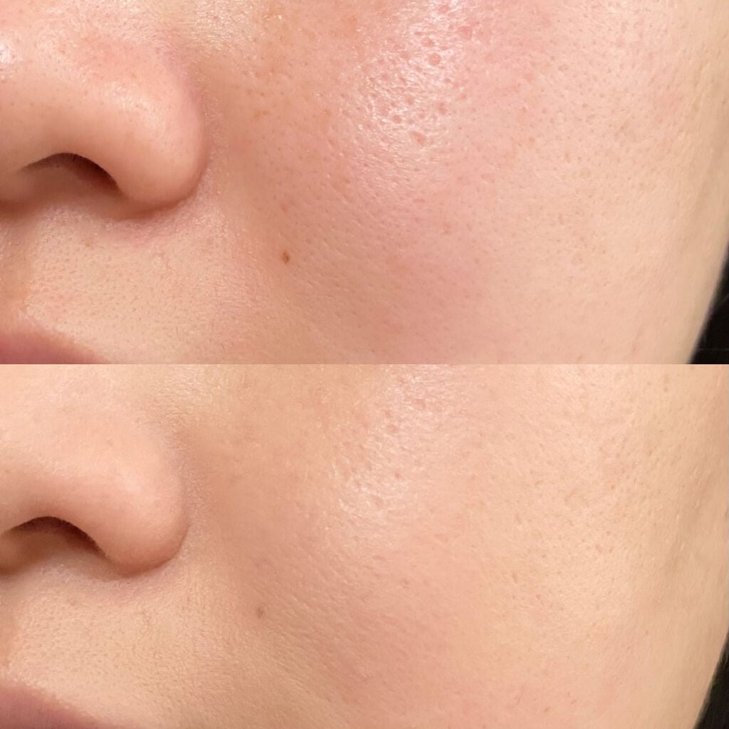 ピンクティーツリーカバークッション/APLIN/クッションファンデーションを使ったクチコミ(4枚目)