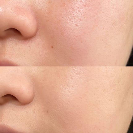 ピンクティーツリーカバークッション/APLIN/クッションファンデーションを使ったクチコミ(4枚目)