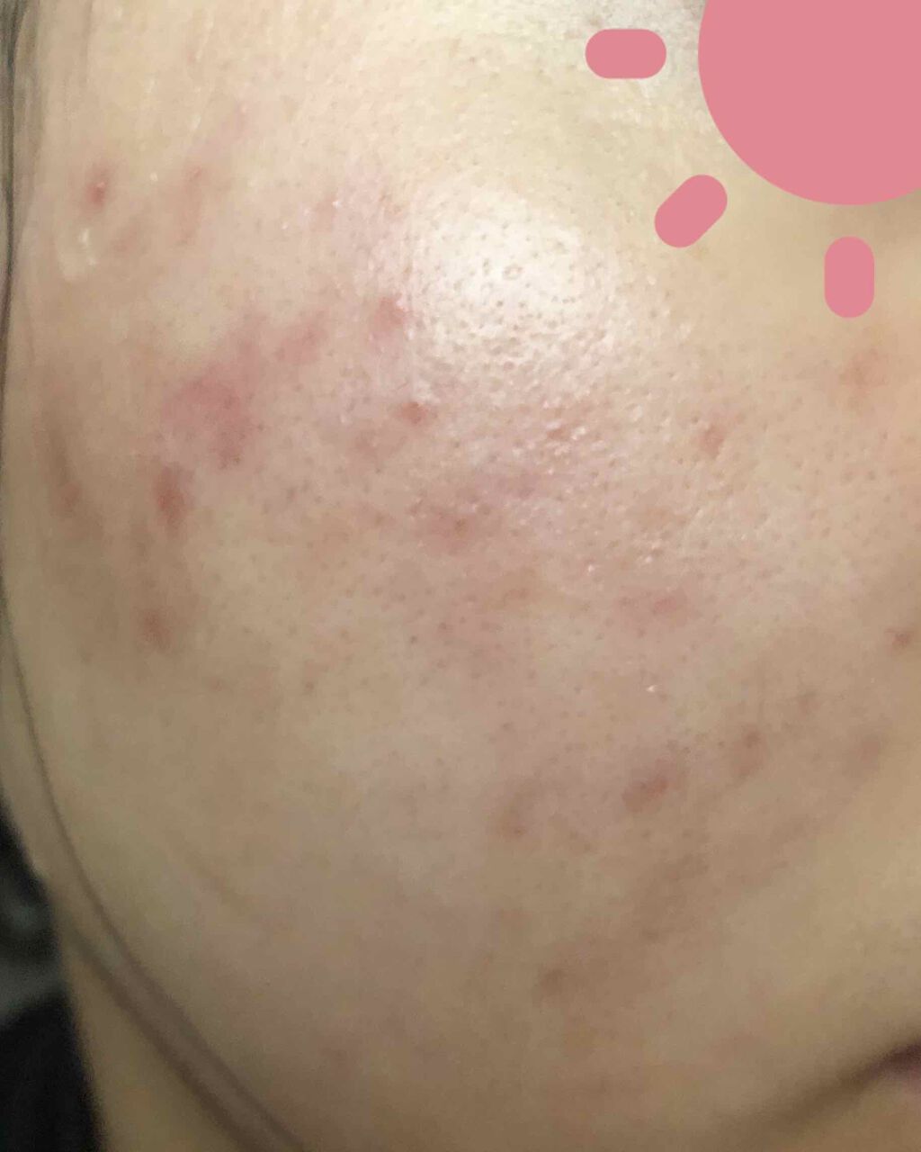 化粧水・敏感肌用・高保湿タイプ/無印良品/化粧水を使ったクチコミ(3枚目)