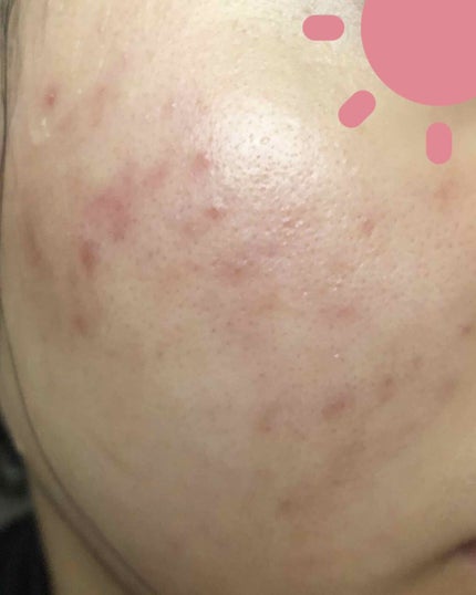 化粧水・敏感肌用・高保湿タイプ/無印良品/化粧水を使ったクチコミ(3枚目)