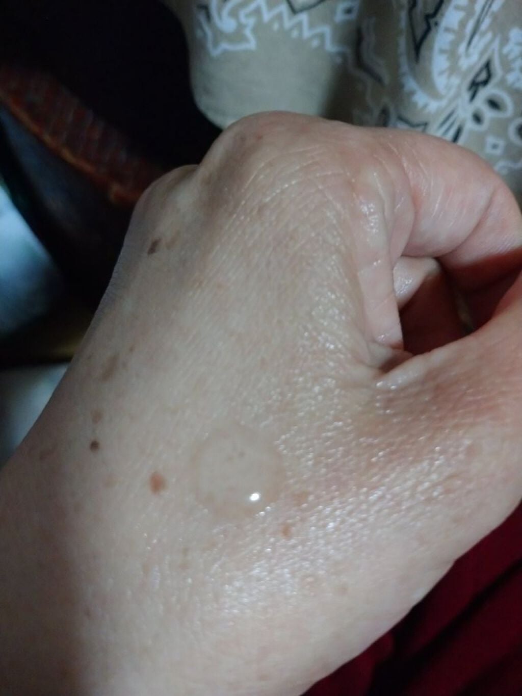 美白美容液 VC/ちふれ/美容液を使ったクチコミ(2枚目)